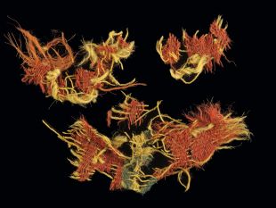 Click image for larger version

Name:	microscopic_woolen_textile_from_Timna.jpg
Views:	1
Size:	15.3 KB
ID:	13839